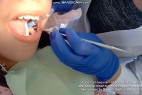beauty with braces gets cavity filling