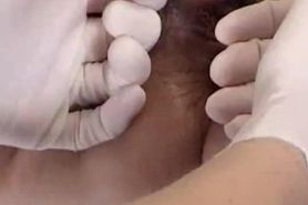 exam_Pelvic