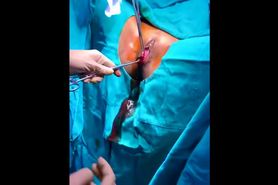 The surgeon treats the patient hymen
