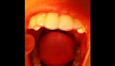 Asian Girl Gagging Herself (and slightly showing her epiglottis ...