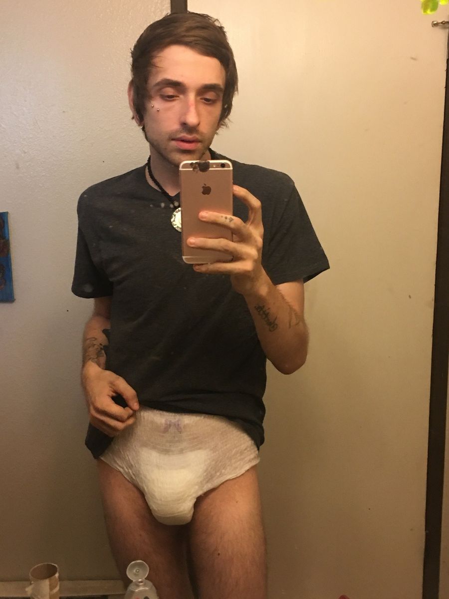 Diapered male